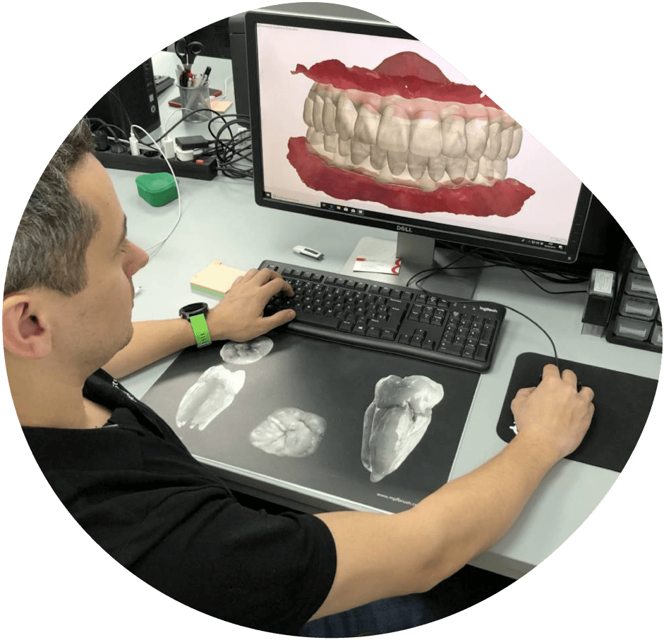 laboratorio dental cdmx